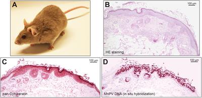 Cutaneous Papillomaviruses and Non-melanoma Skin Cancer: Causal Agents or Innocent Bystanders?